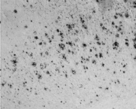 Dense amyloid plaque in untreated Alzheimer mouse brain tissue, original grayscale histology